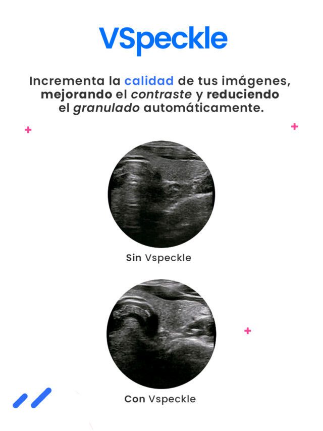 Tecnología Vinno