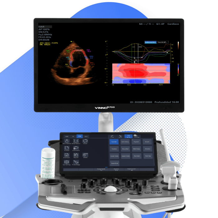 Equipo de ultrasonido Vinno R700 con configuración para cardiología